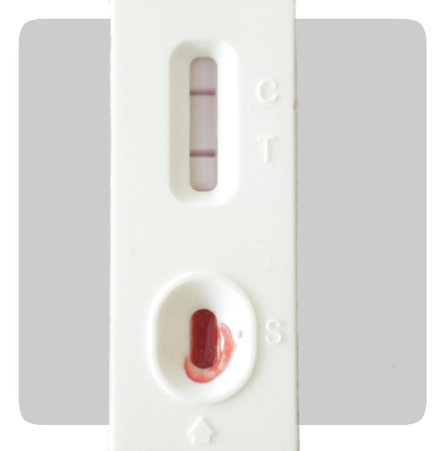 So wird es gemacht - HIV selbst-testen